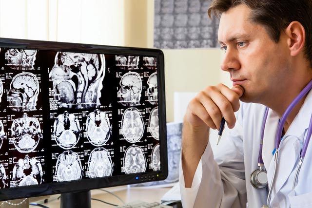 Doctor looking at scan of brain